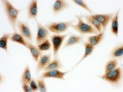 ICC testing of human A549 cells with COMT antibody.