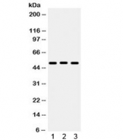 Western blot testing of 1) rat liver, 2) mouse liver, 3) human A549 lysate with BMP5 antibody. Expected/observed molecular weight ~51 kDa.