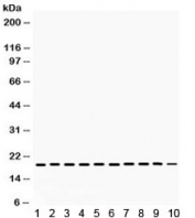 Western blot testing of 1) rat testis, 2) rat lung, 3) rat ovary, 4) mouse liver, 5) mouse brain, 6) mouse lung, and human 7) HeLa, 8) Jurkat, 9) A549, 10) SMMC lysate with Cofilin antibody. Expected/observed molecular weight ~19 kDa.