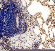 IHC staining of FFPE rat lung tissue with Cyclin D1 antibody, HRP-secondary and DAB substrate. HIER: boil tissue sections in pH8 EDTA for 20 min and allow to cool before testing.