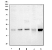 Western blot testing of 1) human HeLa, 2) human SH-SY5Y, 3) human MCF7, 4) rat lung and 5) mouse Neuro-2a cell lysate with Cyclin D1 antibody. Predicted molecular weight: 32-36 kDa.