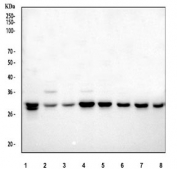 Western blot testing of human 1) Jurkat, 2) HepG2, 3) U-2 OS, 4) K562, 5) T-47D, 6) Caco-2, 7) 293T and 8) PC-3 cell lysate with Cdk2 antibody. Predicted molecular weight ~33 kDa.