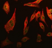 Immunofluorescent staining of FFPE human A549 cells with Cdk2 antibody (green) and Beta Tubulin mAb (red). HIER: steam section in pH6 citrate buffer for 20 min.
