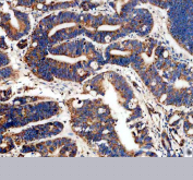 IHC staining of FFPE human colon tissue with MAOB antibody, HRP-secondary and DAB substrate. HIER: boil tissue sections in pH8 EDTA for 20 min and allow to cool before testing.