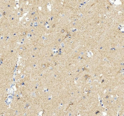 IHC staining of FFPE human brain tissue with MAOB antibody, HRP-secondary and DAB substrate. HIER: boil tissue sections in pH8 EDTA for 20 min and allow to cool before testing.