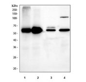 Western blot testing of 1) human HCCT, 2) human HCCP, 3) rat liver and 4) mouse liver tissue lysate with MAOB antibody. Predicted weight ~59 kDa.