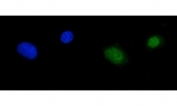 Immunofluorescent staining of FFPE human A549 cells with RPA1 antibody (green) and DAPI nuclear stain (blue). HIER: steam section in pH6 citrate buffer for 20 min.