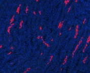 Immunofluorescent staining of FFPE rat kidney tissue with Aquaporin 1 antibody. HIER: boil tissue sections in pH8 EDTA for 20 min and allow to cool before testing.