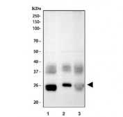 Western blot testing of 1) rat kidney, 2) mouse kidney and 3) mouse lung tissue lysate with Aquaporin 1 antibody. Expected molecular weight ~28 kDa.