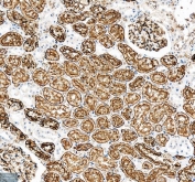 IHC staining of FFPE human kidney tissue with Aquaporin 1 antibody. HIER: boil tissue sections in pH8 EDTA for 20 min and allow to cool before testing.