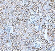 IHC staining of FFPE mouse kidney tissue with Aquaporin 1 antibody. HIER: boil tissue sections in pH8 EDTA for 20 min and allow to cool before testing.