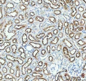 IHC staining of FFPE rat kidney tissue with Aquaporin 1 antibody. HIER: boil tissue sections in pH8 EDTA for 20 min and allow to cool before testing.