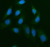 Immunofluorescent staining of FFPE human U-2 OS cells with CDC25B antibody (green) and DAPI nuclear stain (blue). HIER: steam section in pH6 citrate buffer for 20 min.