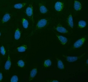 Immunofluorescent staining of FFPE human U-2 OS cells with SDHA antibody (green) and DAPI nuclear stain (blue). HIER: steam section in pH6 citrate buffer for 20 min.