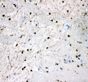 IHC staining of FFPE mouse brain tissue with SERT antibody. HIER: boil tissue sections in pH8 EDTA for 20 min and allow to cool before testing.