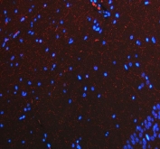 Immunofluorescent staining of FFPE rat brain tissue with SERT antibody (red) and DAPI nuclear stain (blue). HIER: steam section in pH8 EDTA buffer for 20 min.
