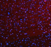 Immunofluorescent staining of FFPE mouse brain tissue with SERT antibody (red) and DAPI nuclear stain (blue). HIER: steam section in pH8 EDTA buffer for 20 min.