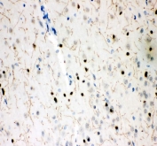 IHC staining of FFPE rat brain tissue with SERT antibody. HIER: boil tissue sections in pH8 EDTA for 20 min and allow to cool before testing.