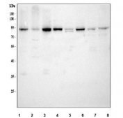 Western blot testing of 1) human SH-SY5Y, 2) human U-2 OS, 3) human SW620, 4) human HeLa, 5) rat brain, 6) rat C6, 7) mouse brain and 8) mouse Neuro-2a cell lysate with SERT antibody. Expected molecular weight: ~70/85-95 kDa (unmodified/glycosylated).
