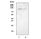 Western blot testing of 1) rat testis and 2) mouse testis tissue lysate with SERT antibody. Expected molecular weight: ~70/85-95 kDa (unmodified/glycosylated).