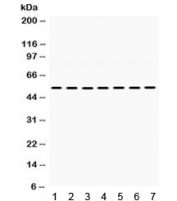Western blot testing of 1) rat heart, 2) rat brain, 3) rat liver, 4) mouse liver, 5) mouse lung, 6) human 22RV1, and 7) human SMMC lysate with ADRA1A antibody. Expected/observed molecular weight ~52 kDa.