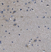 IHC staining of FFPE rat brain with ADRA1A antibody. HIER: boil tissue sections in pH6, 10mM citrate buffer, for 20 min and allow to cool before testing.