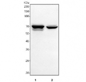 Western blot testing of human 1) HepG2 and 2) A549 cell lysate with TGF beta Receptor II antibody. Expected molecular weight ~65 kDa, routinely observed at 65-80 kDa.
