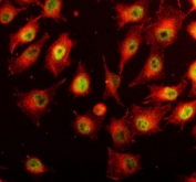 Immunofluorescent staining of FFPE human A549 cells with STAT3 antibody (green) and Beta Tubulin mAb (red). HIER: steam section in pH6 citrate buffer for 20 min.