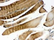 IHC testing of FFPE mouse skeletal muscle with MKK3 antibody. HIER: Boil the paraffin sections in pH 6, 10mM citrate buffer for 20 minutes and allow to cool prior to staining.