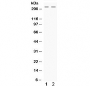 Western blot testing of human 1) HeLa and 2) HepG2 cell lysate with Nestin antibody. Predicted molecular weight ~177 kDa but can be observed at up to 280 kDa.