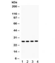 Western blot testing of 1) rat brain, 2) rat spleen, 3) rat kidney and 4) human SMMC lysate with Flt3 ligand antibody. Predicted/observed molecular weight ~26 kDa.