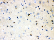 IHC testing of FFPE rat brain with APLP1 antibody. HIER: Boil the paraffin sections in pH 6, 10mM citrate buffer for 20 minutes and allow to cool prior to staining.