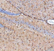 IHC testing of FFPE mouse brain with AQP4 antibody. HIER: Boil the paraffin sections in pH 8 EDTA buffer for 20 minutes and allow to cool prior to staining.