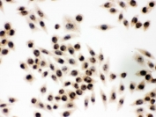 IHC testing of FFPE human SMMC-7221 cells with Eukaryotic Translation Initiation Factor 6 antibody. HIER: Boil the paraffin sections in pH 6, 10mM citrate buffer for 20 minutes and allow to cool prior to staining.