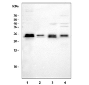 Western blot testing of 1) rat brain, 2) rat PC-12, 3) mouse brain and 4) mouse stomach tissue lysate with RAB14 antibody. Expected/observed molecular weight ~24 kDa.