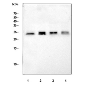 Western blot testing of human 1) HeLa, 2) SiHa, 3) RT4 and 4) MCF7 cell lysate with RAB14 antibody. Expected/observed molecular weight ~24 kDa.