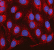 Immunofluorescent staining of FFPE human U-2 OS cells with RAB14 antibody (red) and DAPI nuclear stain (blue). HIER: steam section in pH6 citrate buffer for 20 min.