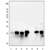 Western blot testing of 1) human ThP1, 2) human HL60, 3) human U937, 4) rat lung, 5) rat PC-12, 6) mouse lung and 7) mouse RAW264.7 cell lysate with Lysozyme antibody. Expected molecular weight ~17 kDa.