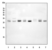 Western blot testing of human 1) rat brain, 2) rat spleen, 3) rat lung, 4) rat PC-12, 5) mouse brain, 6) mouse spleen, 7) mouse lung and 8) mouse NIH 3T3 cell lysate with RAB11 antibody. Predicted molecular weight ~24 kDa.