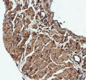 IHC staining of FFPE mouse heart tissue with Actin antibody. HIER: Boil the paraffin sections in pH8 EDTA buffer for 20 minutes and allow to cool prior to staining.