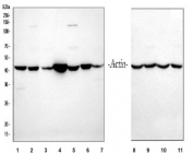 Western blot testing of 1) rat heart, 2) rat brain, 3) rat kidney, 4) mouse heart, 5) mouse brain, 6) mouse spleen, 7) mouse kidney, 8) human HeLa, 9) human HepG2, 10) human 293T and 11) human A431 cell lysate with Actin antibody. Expected molecular weight 42-45 kDa.