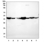 Western blot testing of 1) rat heart, 2) rat brain, 3) rat kidney, 4) mouse heart, 5) mouse brain, 6) mouse spleen and 7) mouse kidney tissue lysate with anti-Actin antibody. Expected molecular weight: 42-45 kDa.