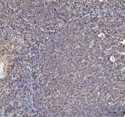IHC staining of FFPE human tonsil tissue with anti-Actin antibody. HIER: boil tissue sections in pH8 EDTA for 20 min and allow to cool before testing.