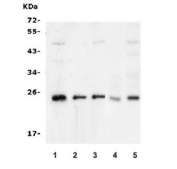 Western blot testing of 1) human Caco-2, 2) human SW620, 3) human PANC-1, 4) rat brain and 5) mouse brain lysate with mtTFA antibody. Expected molecular weight 24~29 kDa.