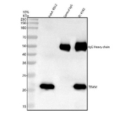 Immunoprecipitation of SMARCAD1 protein from 500ug of human K562 whole cell lysate with 2ug of SMARCAD1 antibody.