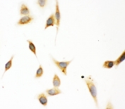 ICC staining of FFPE human A549 cells with ASPH antibody at 1ug/ml. HIER: Boil the paraffin sections in pH 6, 10mM citrate buffer for 20 minutes and allow to cool prior to staining.