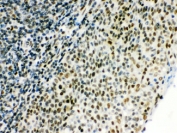 IHC testing of FFPE human tonsil tissue with CTBP1 antibody. HIER: Boil the paraffin sections in pH 6, 10mM citrate buffer for 20 minutes and allow to cool prior to staining.