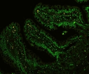 Immunofluorescent staining of FFPE rat intestinal tissue with CTBP1 antibody. HIER: steam section in pH6 citrate buffer for 20 min.