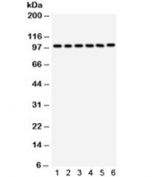 Western blot testing of 1) rat liver, 2) mouse liver, 3) human placenta, 4) HeLa, 5) SMCC and 6) HepG2 lysate with STIM1 antibody. Predicted molecular weight ~77 kDa but may be observed at higher molecular weights due to glycosylation.