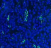 Immunofluorescent staining of FFPE mouse kidney tissue with SLC12A1 antibody (green) and DAPI nuclear stain (blue). HIER: steam section in pH8 EDTA buffer for 20 min.